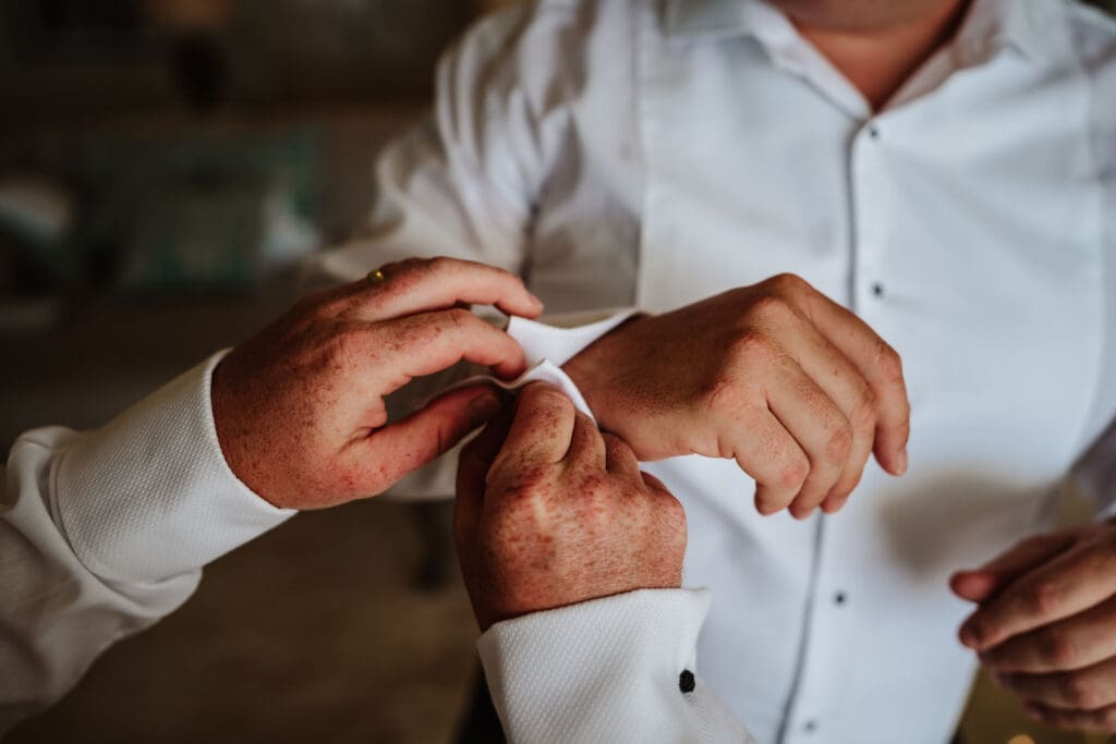 adding the groom's cufflinks captured in wedding photography in Tangier, Morocco by Ben Lee.